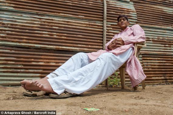 پسری که کسی حاضر نیست با او ازدواج کند+ تصاویر 