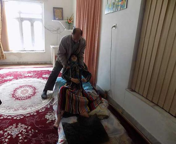 دختری که به مرور همه بدنش استخوان می شود+تصاویر