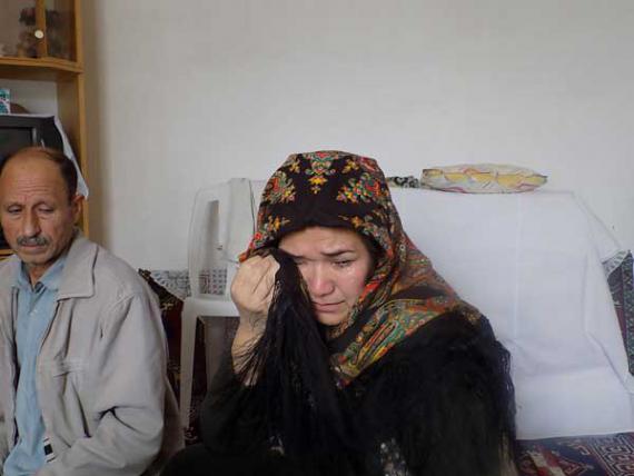 دختری که به مرور همه بدنش استخوان می شود+تصاویر