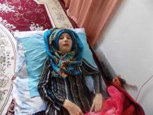 دختری که به مرور همه بدنش استخوان می شود+تصاویر دختری که به مرور همه بدنش استخوان می شود+تصاویر