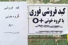 فروش کلیه,فروش کبد,کبد فروشی,آگهی خرید و فروش کلیه ,پیوند عضو,اهدای عضو,shabnamha.ir,شبنم همدان,afkl ih,شبنم ها; 